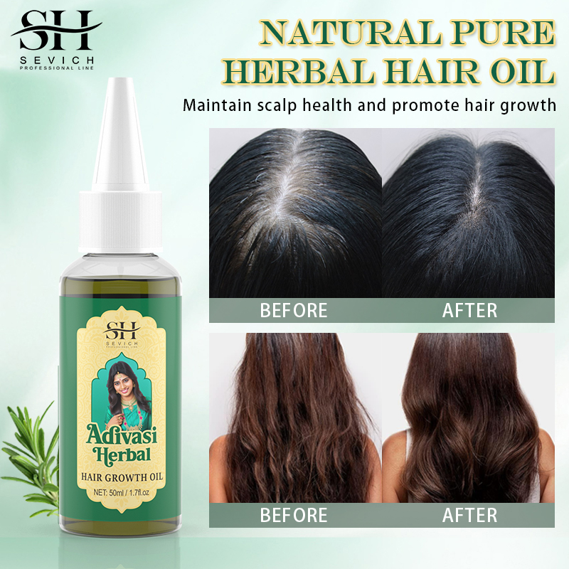 Ayurvedisches Haarwachstumsöl  – Coconut Oil Refined Bewertung und Preis